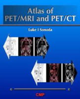 Picture of Atlas of PET/MRI and PET/CT