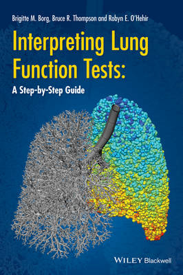 Picture of Interpreting lung function tests: a step-by-step guide