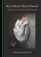 Picture of Acute Right Heart Failure: An Overview of the Heart's Prodigal Chamber