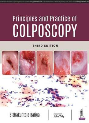 Picture of Principles and Practice of Colposcopy