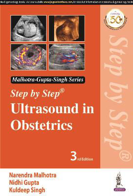 Picture of Step by Step Ultrasound in Obstetrics