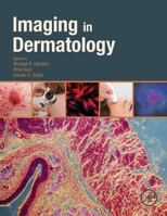 Picture of Imaging in Dermatology