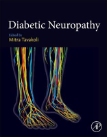 Picture of Diabetic Neuropathy