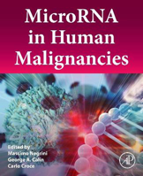 Picture of MicroRNA in Human Malignancies