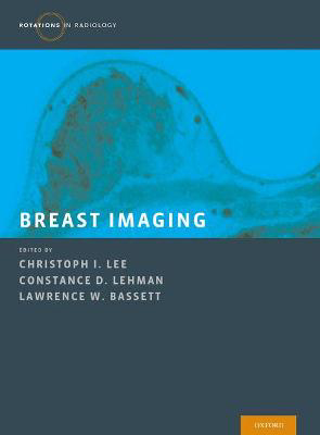 Picture of Breast Imaging