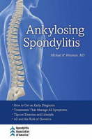 Picture of Ankylosing Spondylitis
