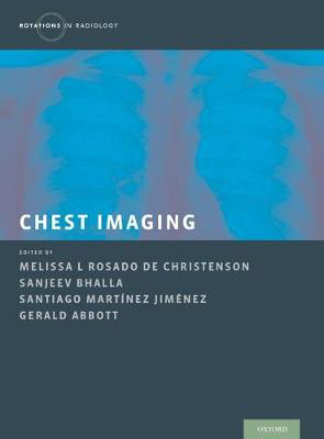 Picture of Chest Imaging