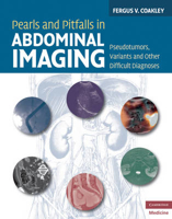 Picture of Pearls and Pitfalls in Abdominal Imaging: Pseudotumors, Variants and Other Difficult Diagnoses