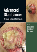 Picture of Advanced Skin Cancer: A Case-Based Approach