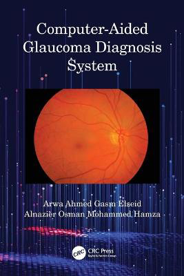 Picture of Computer-Aided Glaucoma Diagnosis System