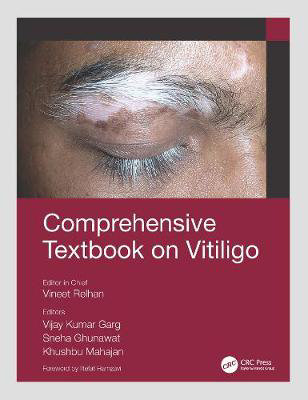 Picture of Comprehensive Textbook on Vitiligo