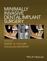 Picture of Minimally Invasive Dental Implant Surgery