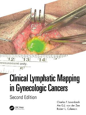 Picture of Clinical Lymphatic Mapping in Gynecologic Cancers