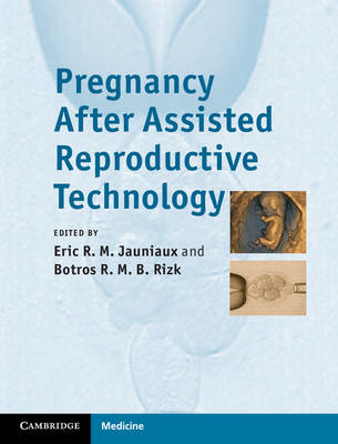 Picture of Pregnancy After Assisted Reproductive Technology