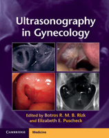 Picture of Ultrasonography in Gynecology