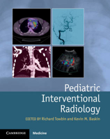 Picture of Pediatric Interventional Radiology