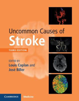 Picture of Uncommon Causes of Stroke