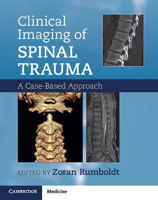 Picture of Clinical Imaging of Spinal Trauma: A Case-Based Approach