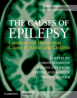 Picture of The Causes of Epilepsy: Common and Uncommon Causes in Adults and Children