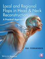 Picture of Local and Regional Flaps in Head and Neck Reconstruction: A Practical Approach