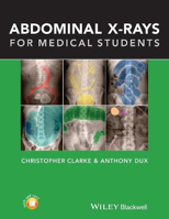 Picture of Abdominal X-rays for Medical Students