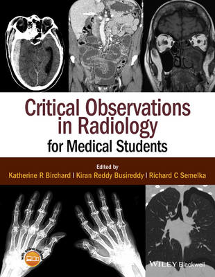 Picture of Critical Observations in Radiology for Medical Students