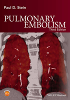Picture of Pulmonary Embolism