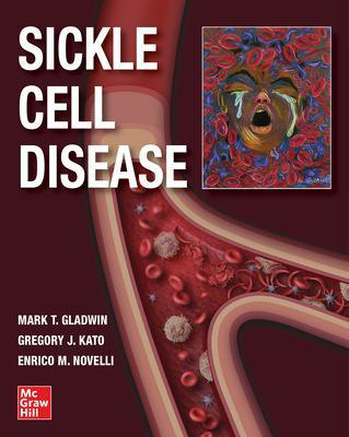 Picture of SICKLE CELL DISEASE