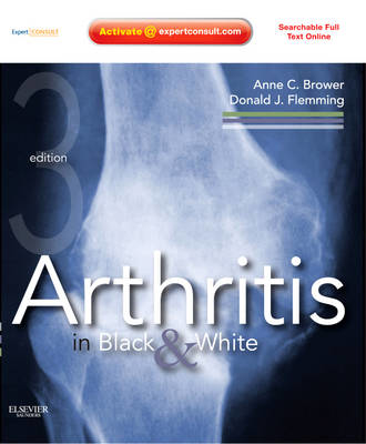 Picture of Arthritis in Black and White: Expert Consult - Online and Print