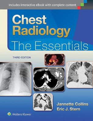 Picture of Chest Radiology: The Essentials