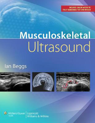 Picture of Musculoskeletal Ultrasound