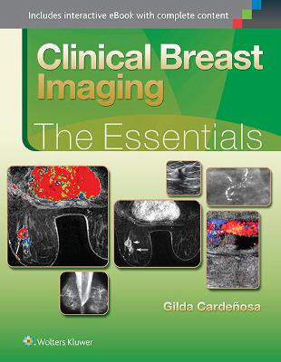 Picture of Clinical Breast Imaging: The Essentials