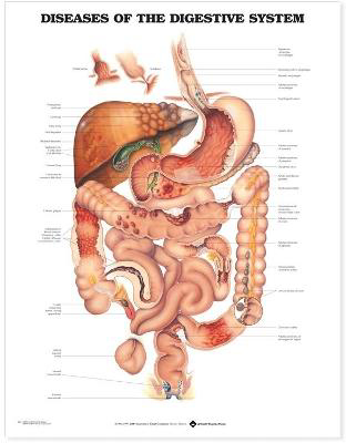 Picture of Diseases of the Digestive System Anatomical Chart