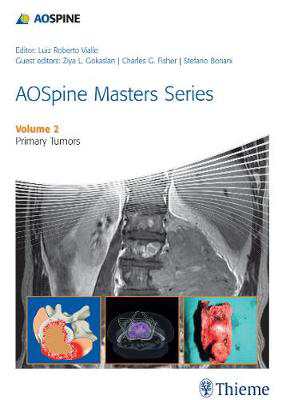 Picture of AOSpine Masters Series Volume 2: Primary Spinal Tumors