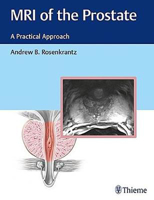 Picture of MRI of the Prostate: A Practical Approach