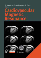 Picture of Cardiovascular Magnetic Resonance