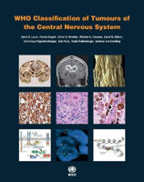 Picture of WHO classification of tumours of the central nervous system