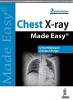 Picture of Chest X-ray Made Easy