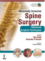 Picture of Minimally Invasive Spine Surgery