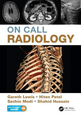 Picture of On Call Radiology