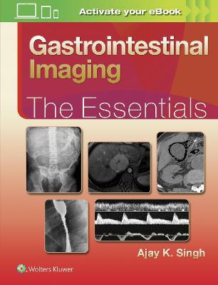 Picture of Gastrointestinal Imaging: The Essentials