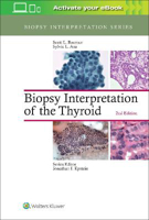Picture of Biopsy Interpretation of the Thyroid