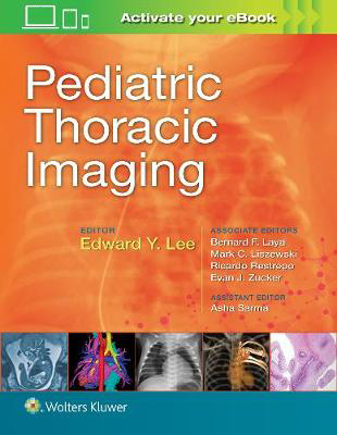 Picture of Pediatric Thoracic Imaging