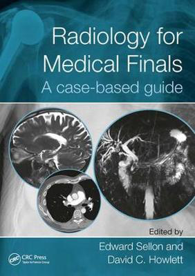 Picture of Radiology for Medical Finals: A case-based guide