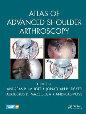 Picture of Atlas of Advanced Shoulder Arthroscopy