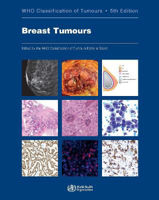 Picture of WHO Classification of Breast Tumours: WHO Classification of Tumours, Volume 2