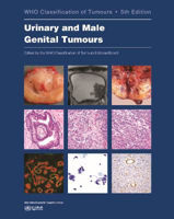 Picture of WHO classification of tumours of the urinary system and male genital organs