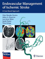 Picture of Endovascular Management of Ischemic Stroke: A Case-Based Approach