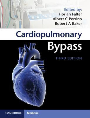 Picture of Cardiopulmonary Bypass