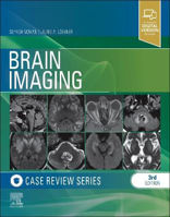 Picture of Brain Imaging: Case Review Series